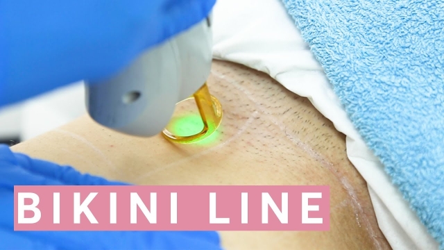 Laser Hair Removal: Unveiling the Secret to Smooth Skin
