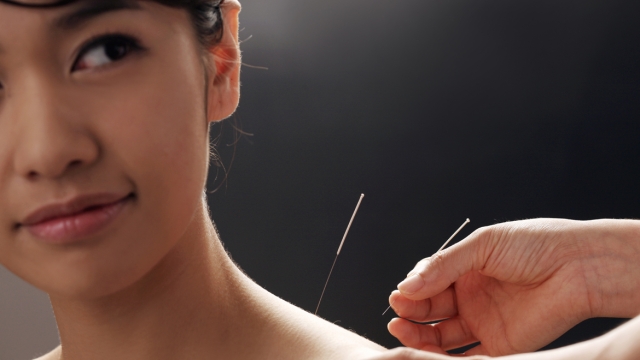 The Art of Healing Through Acupuncture: Unveiling the Path to Balance and Wellness